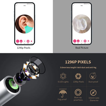 Smart Visual Ear CleanerPro